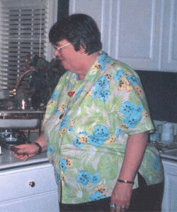 Before Weight Loss Photo